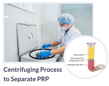 Centrifuging-Process to-Separate PRP