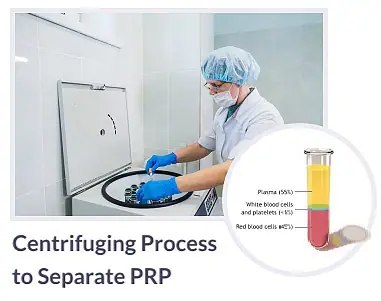 Centrifuging-Process to-Separate PRP