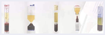 Platelet-rich-plasma-therapy