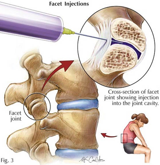 Short-Ter-Treatments-image