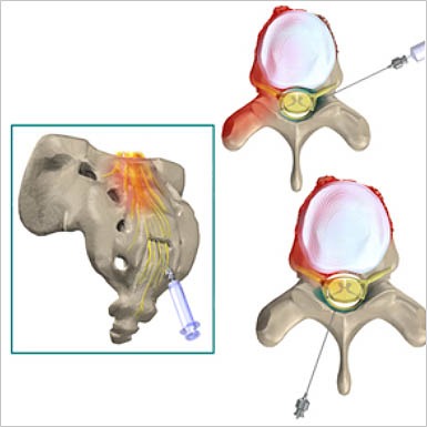 Treatments-back-pain-image