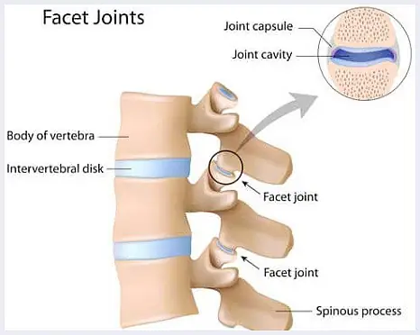 fact-joints-image