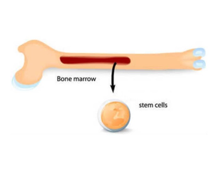 Cellular Therapy